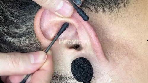 助眠掏耳朵视频,掏耳朵视频带你进入深度睡眠之旅